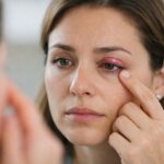 눈꺼풀에 다래끼가 생겨 붓고 통증을 느끼는 여성의 눈 모습